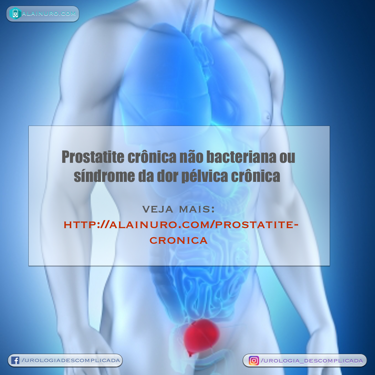 prostatite bacteriana crônica sintomas