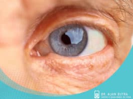 Glaucoma e degeneração macular - Remédios naturais